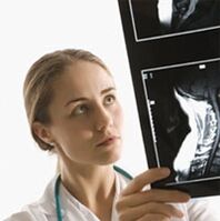 Ọzịza nke osteochondrosis akọwapụtara site na iji nyocha X -A