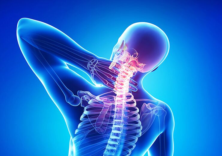 Ọkpụkpụ osteochondrosis bụ ọrịa nke na-emetụta cartilage articular na vertebrae.